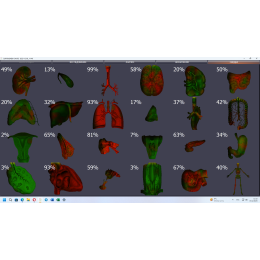 Диагностика ИРИДОСКРИН
